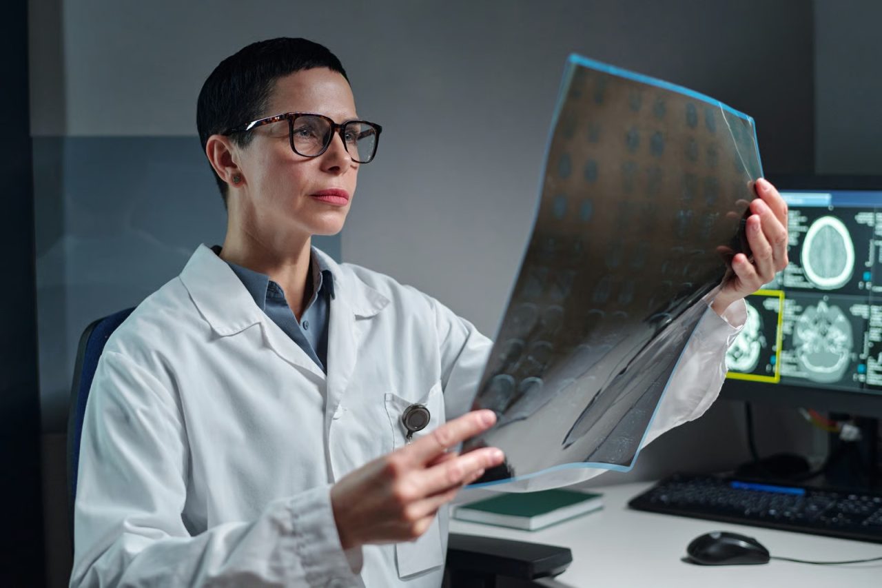 Los tumores cerebrales benignos también pueden afectar funciones vitales, advierte especialista de Cleveland Clinic